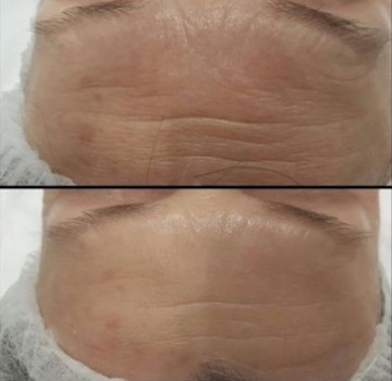 Face Massage Pembrokeshire JW Massage.JPG